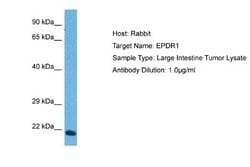 EPDR1 Antibody, Novus Biologicals 100 &mu;L; Unconjugated:Antibodies, Polyclonal